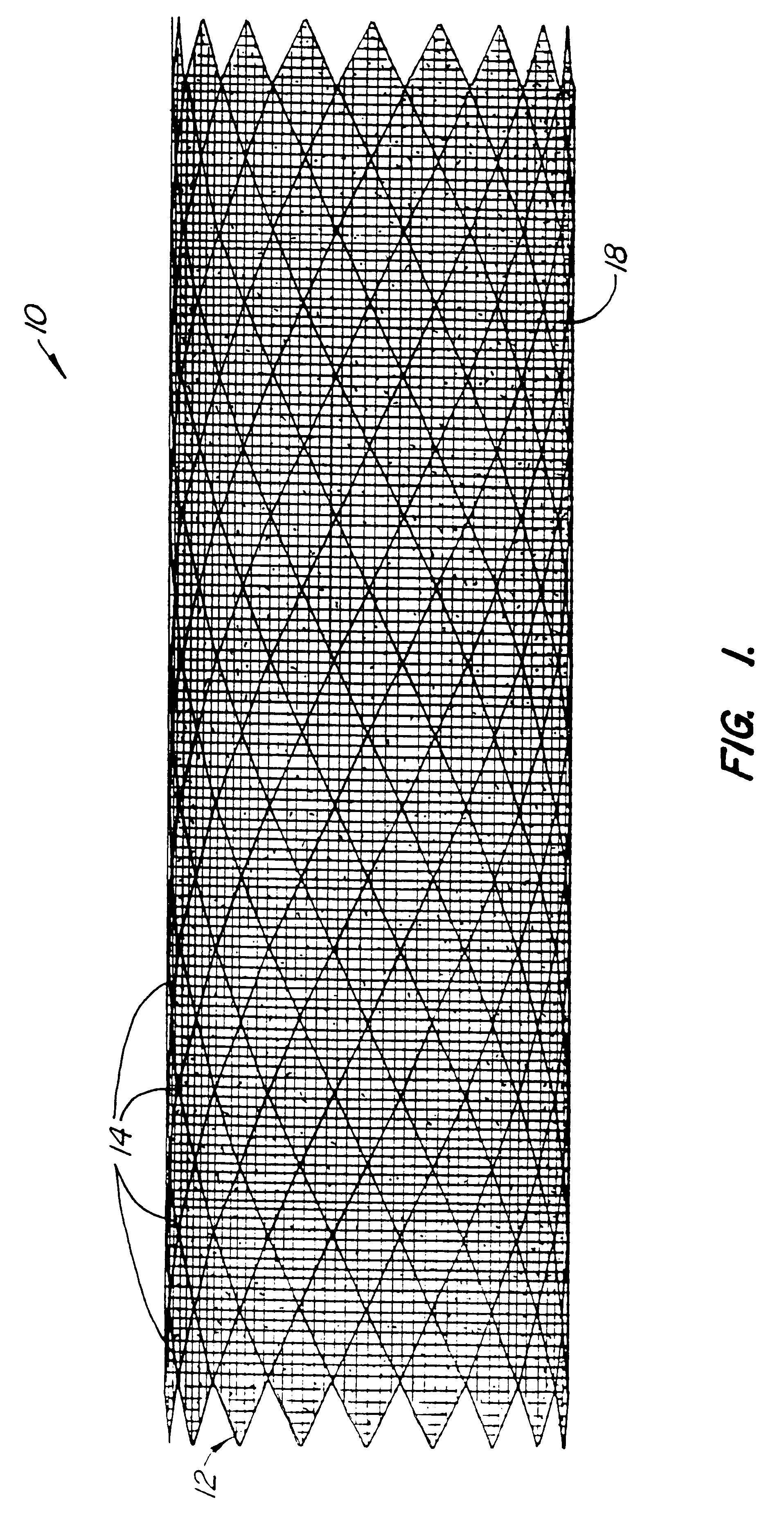 Endoluminal prostheses and therapies for highly variable body lumens