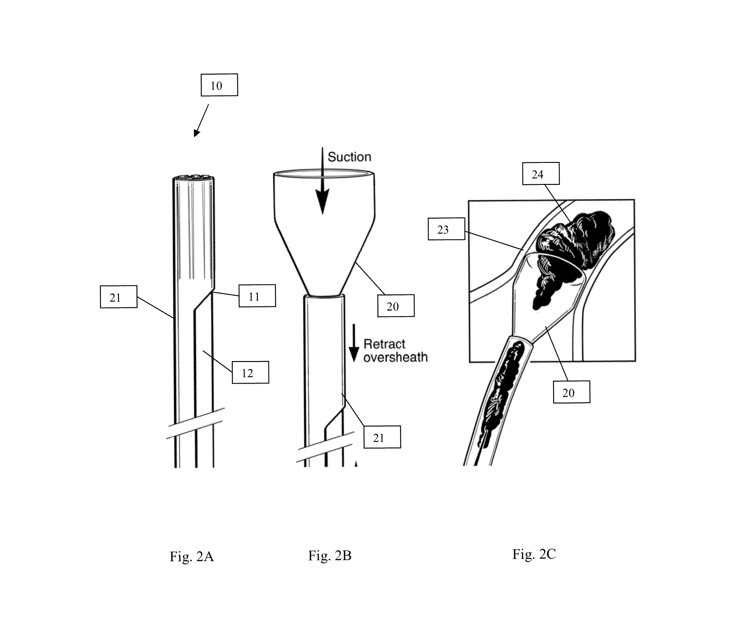 Systems and methods for removing and fragmenting undesirable material within a circulatory system