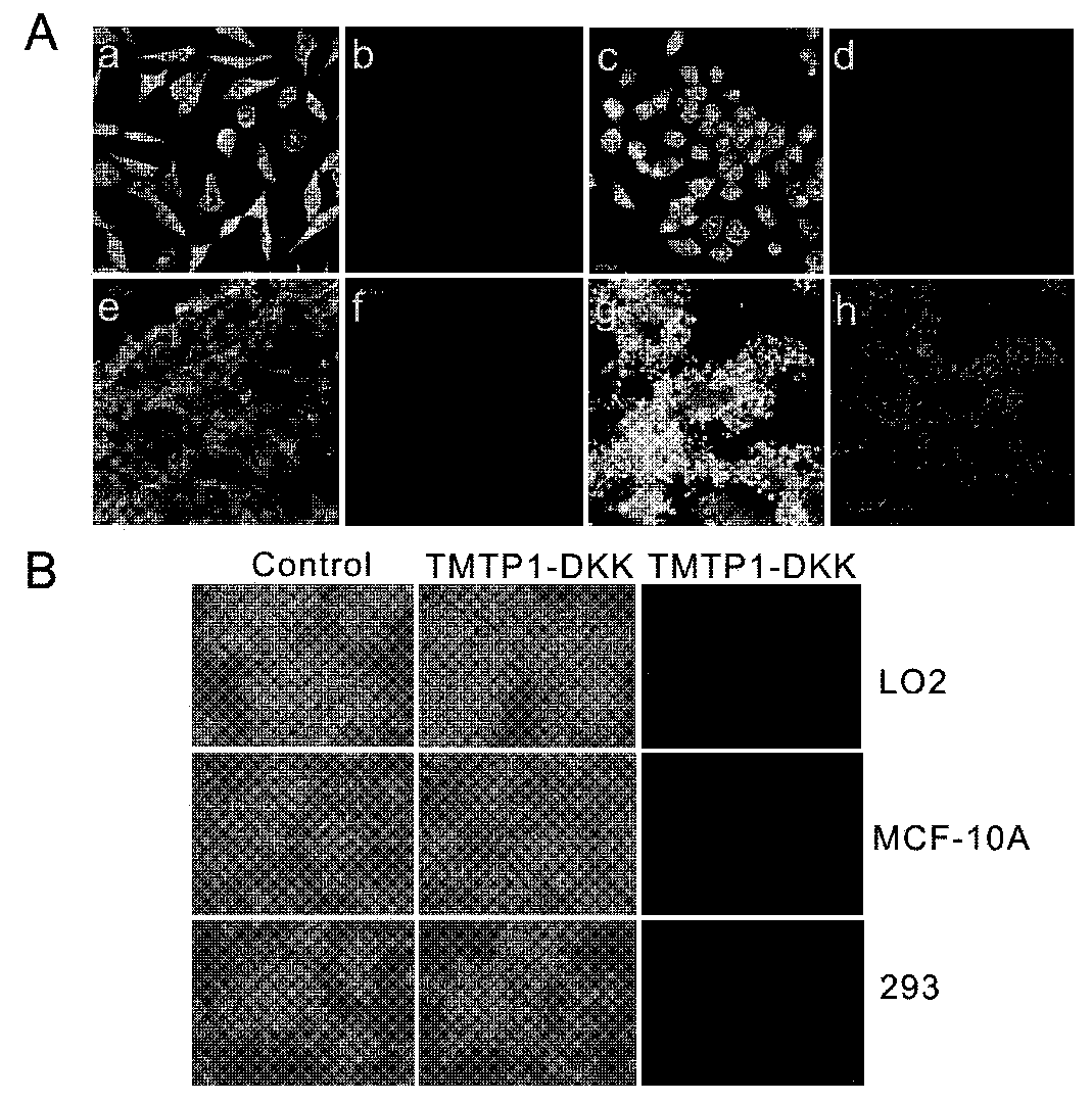 Preparation and application of novel targeting peptide for specifically inhibiting tumor cell metastasis