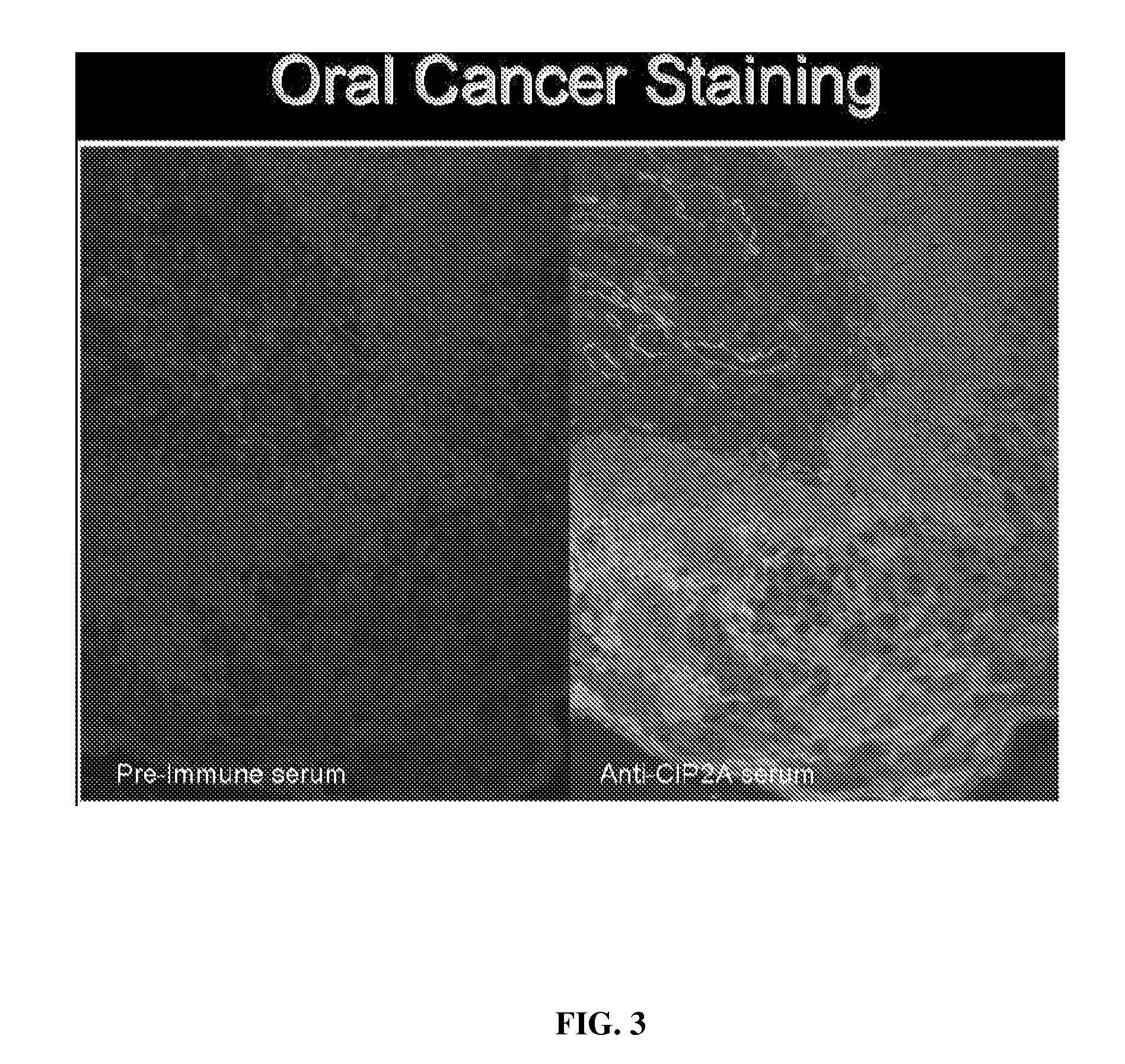 Compositions and methods for detecting cancers in a subject