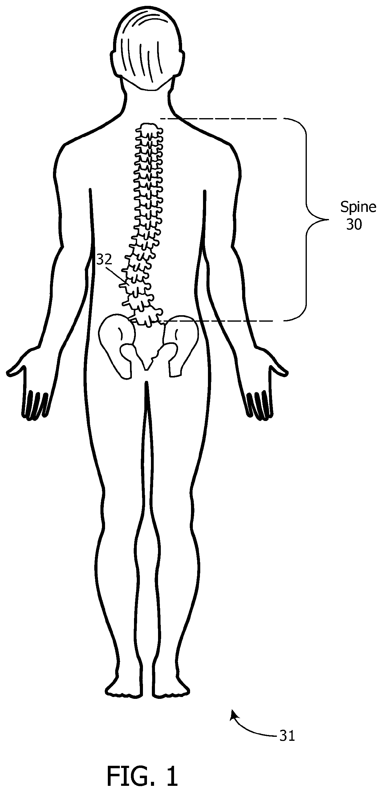 Spinal orthosis