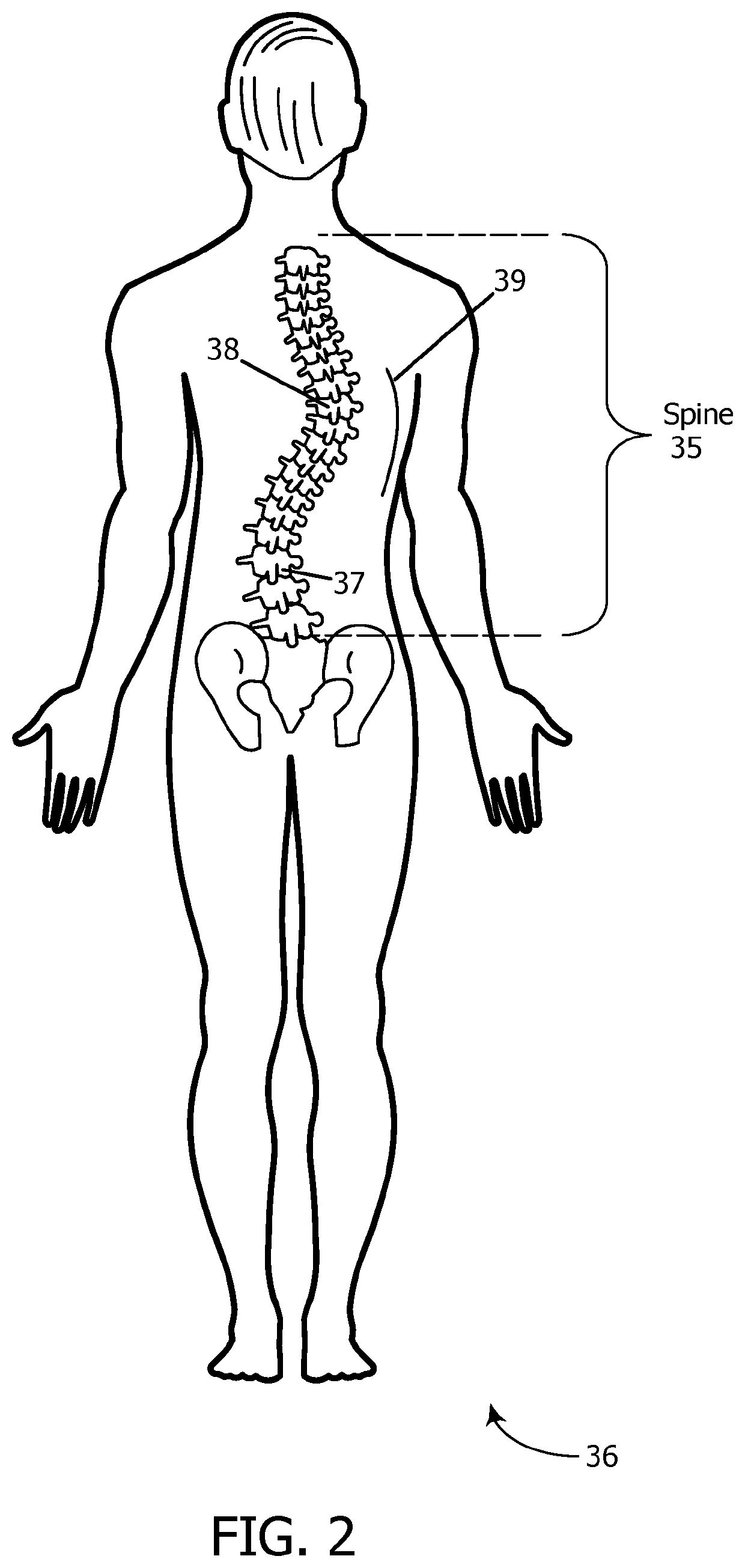 Spinal orthosis