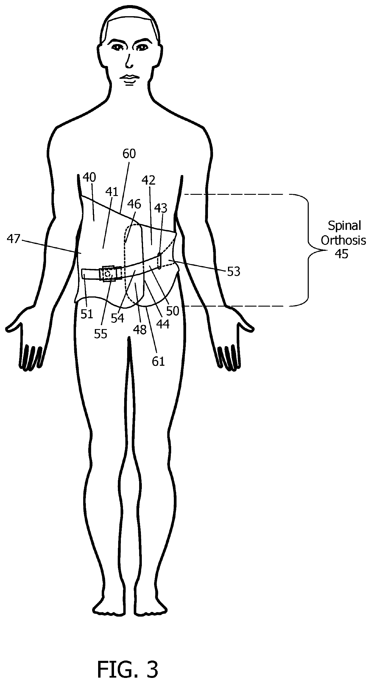 Spinal orthosis