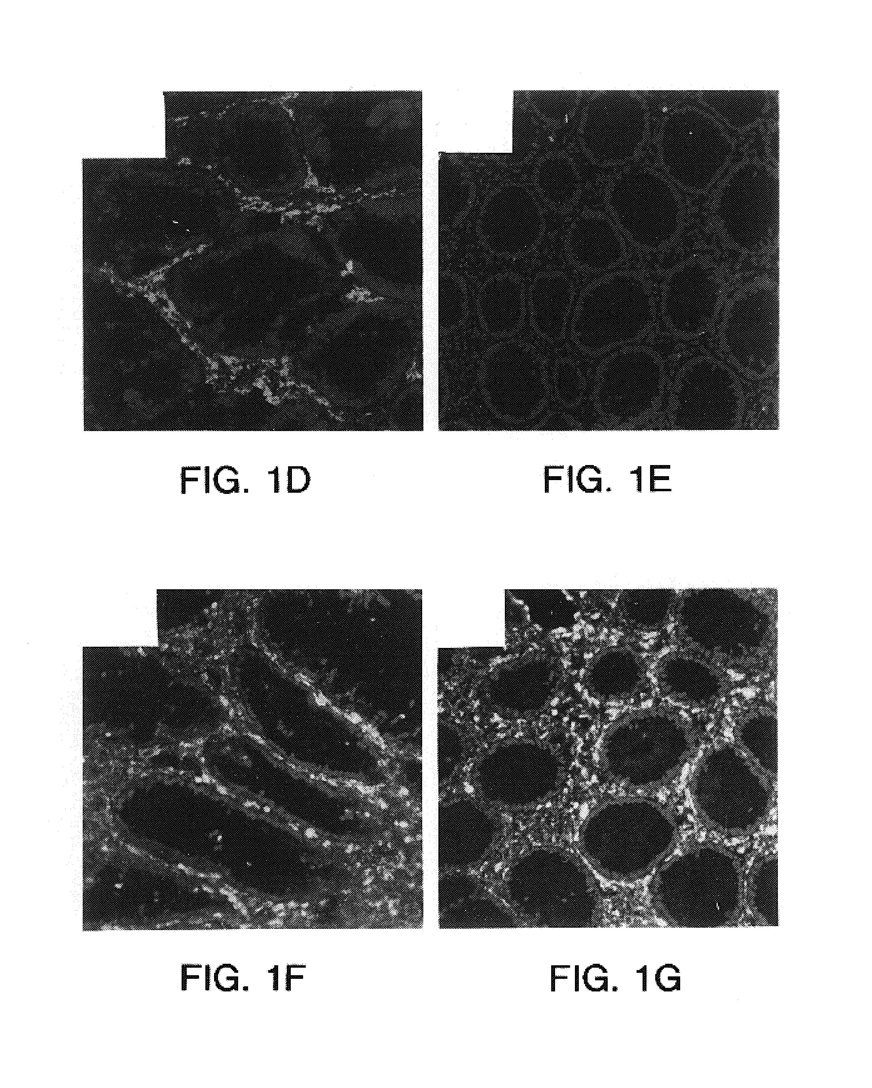 Methods of treatment using wisp polypeptides