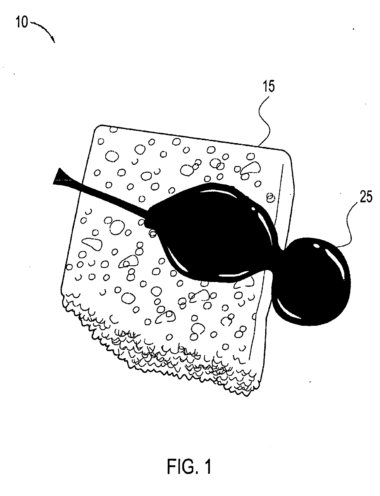 Containment system for delivery of biological products and method of surgery