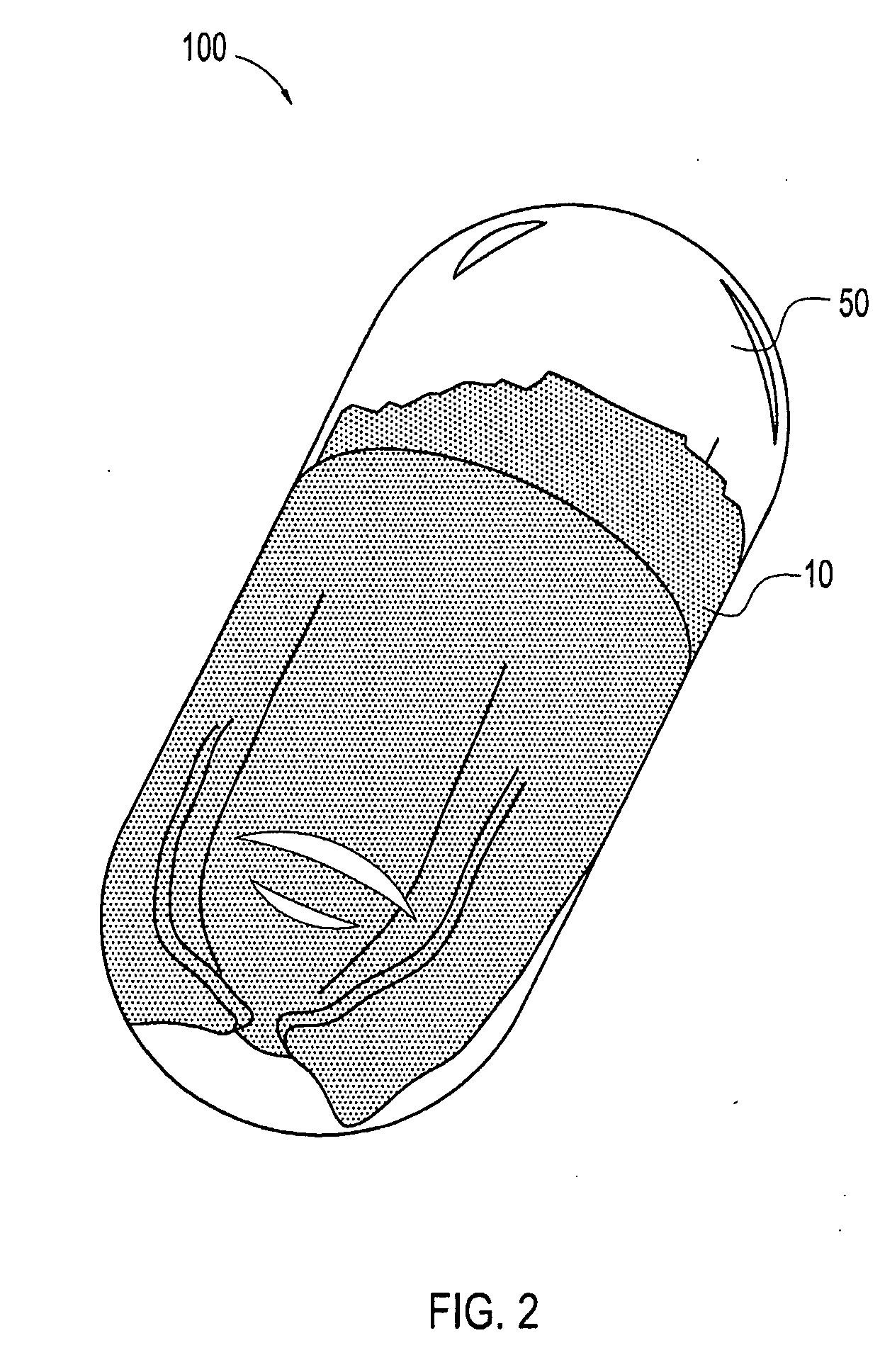 Containment system for delivery of biological products and method of surgery