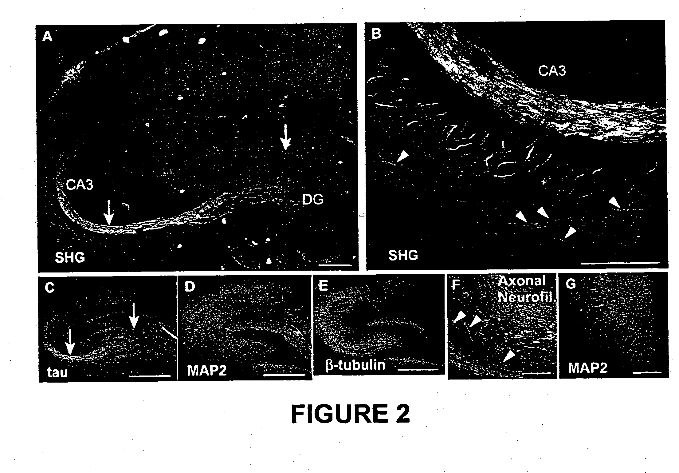 Nonlinear optical detection of fast cellular electrical activity