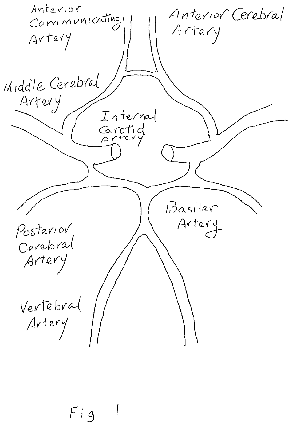 Methods and devices to ameliorate vascular obstruction