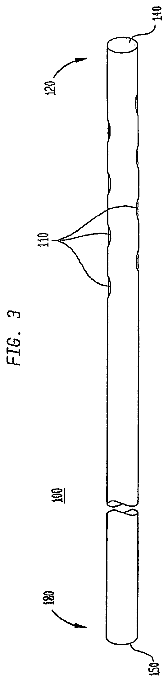 Methods and devices to ameliorate vascular obstruction