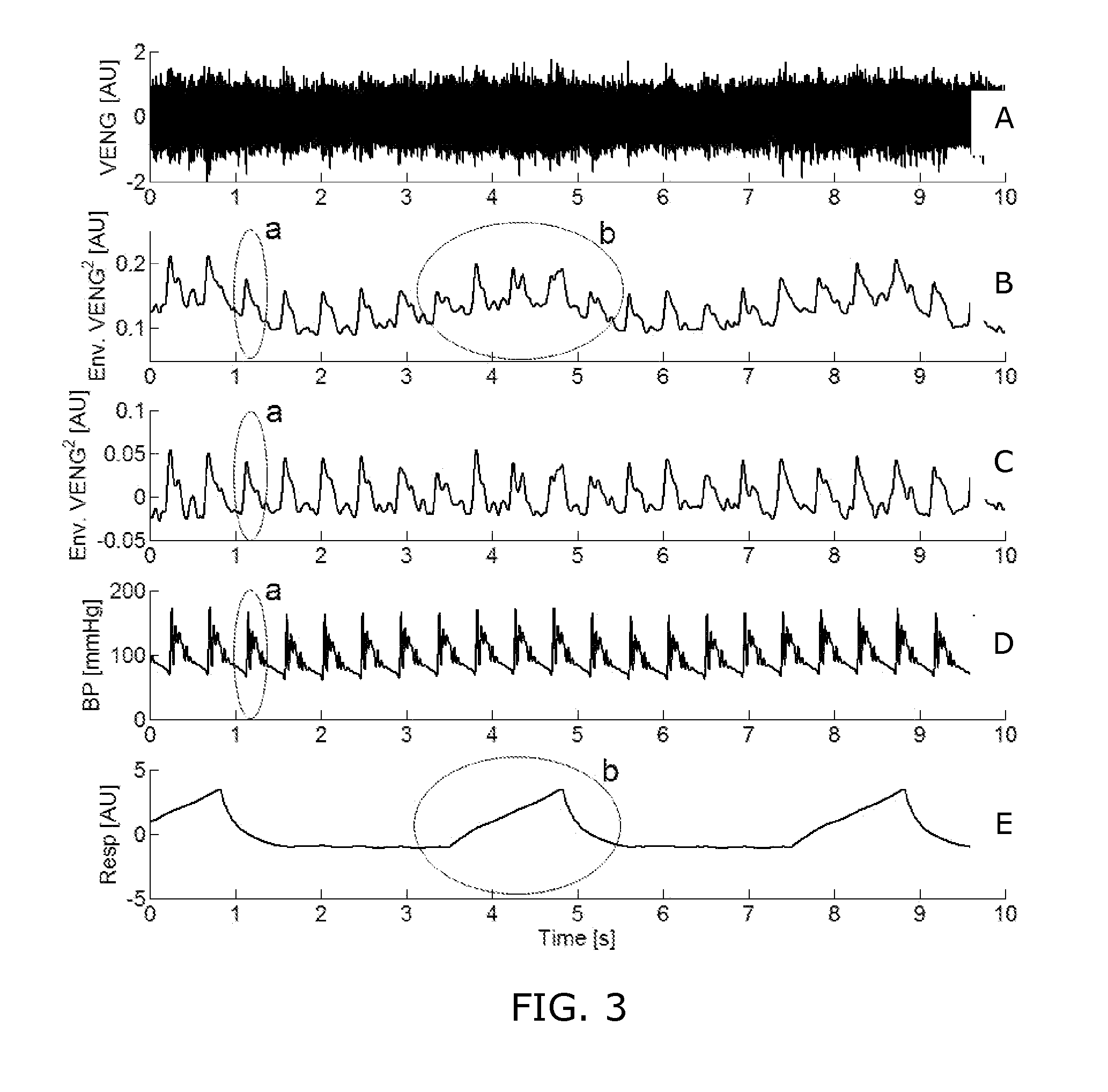 Blood pressure estimation based on neural activity