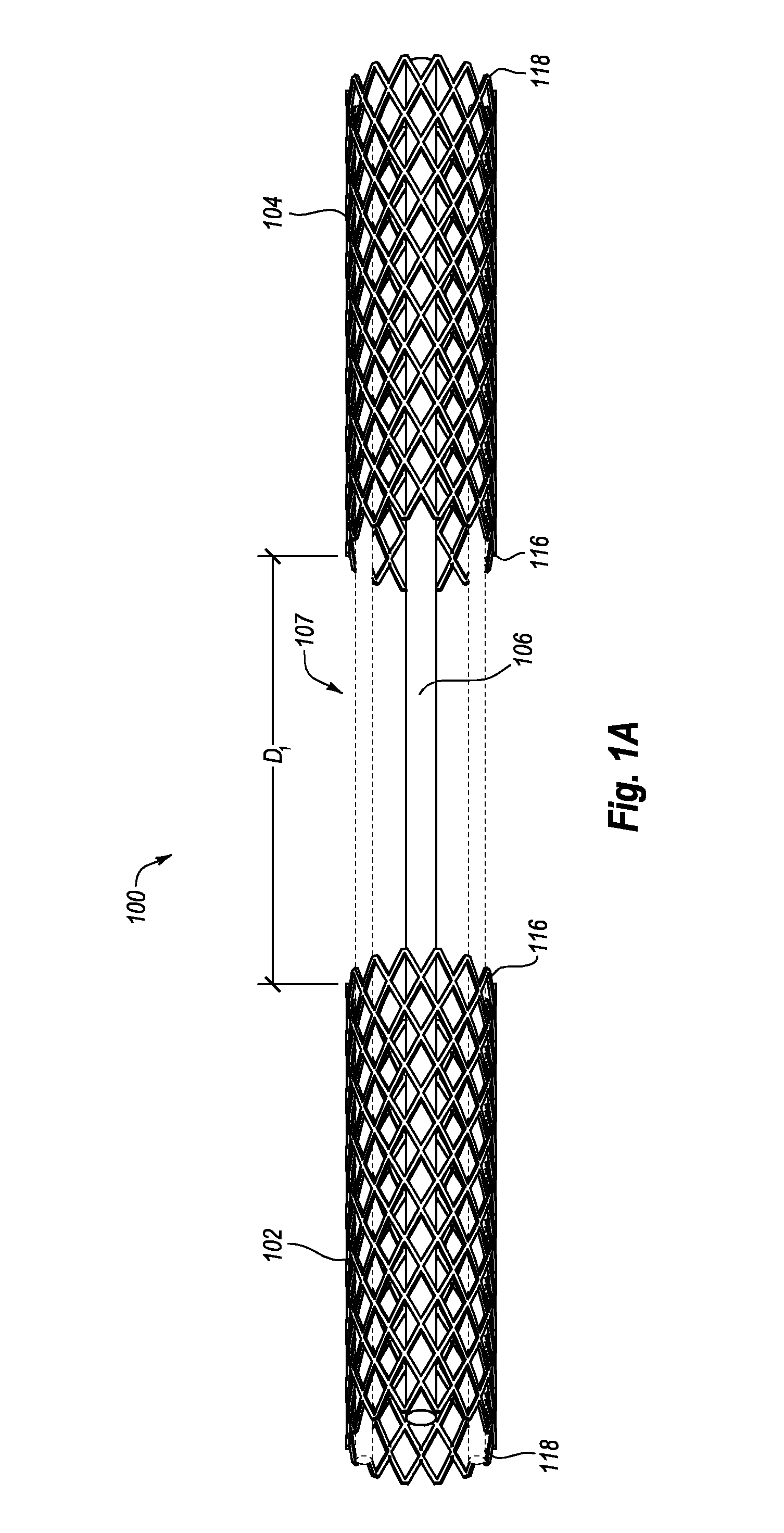 Intravascular cardiac restraining implants and methods for treating heart failure