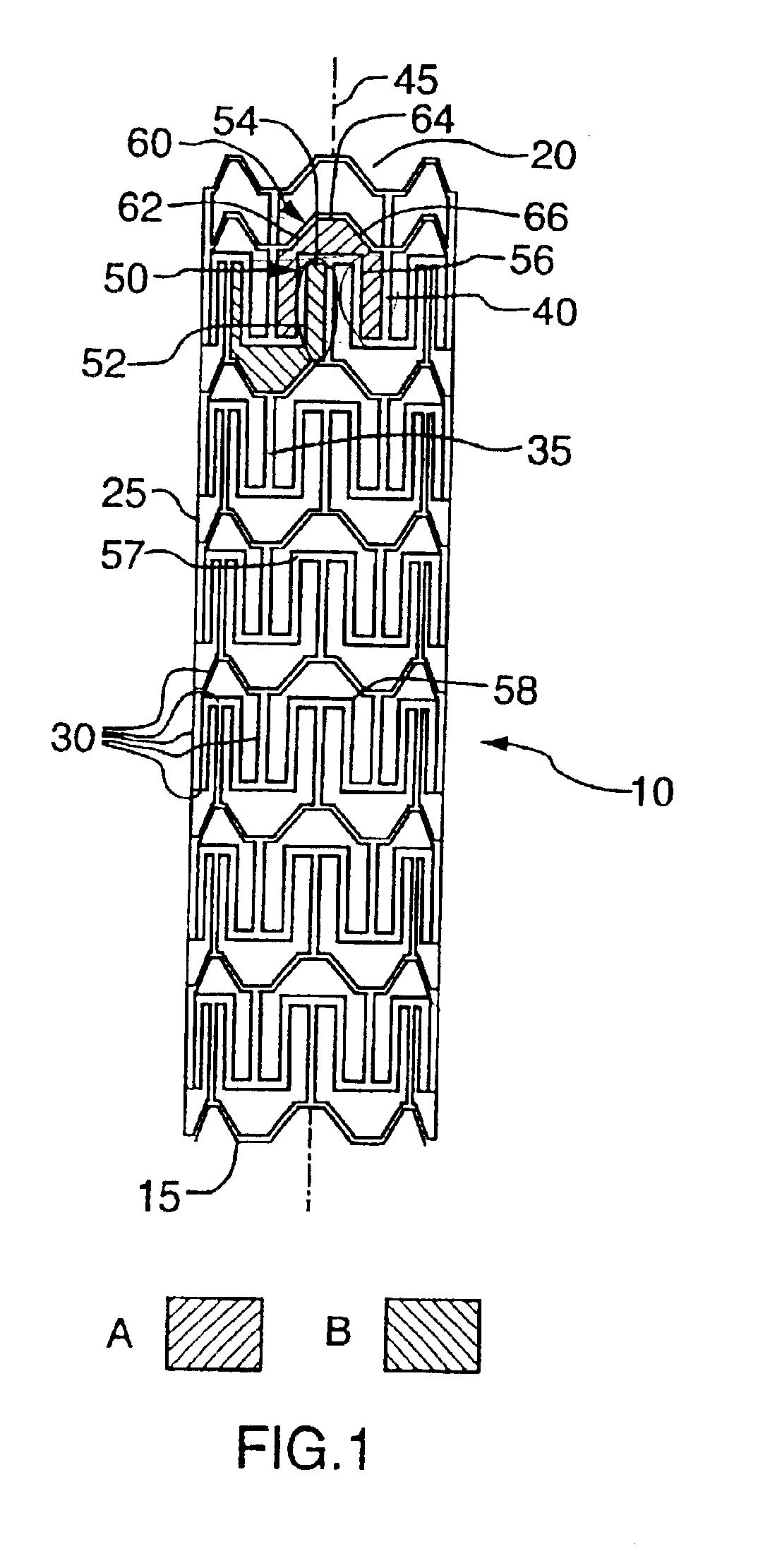 Expandable stent and method for delivery of same