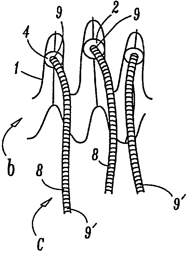 Endovascular prosthesis with suture holder