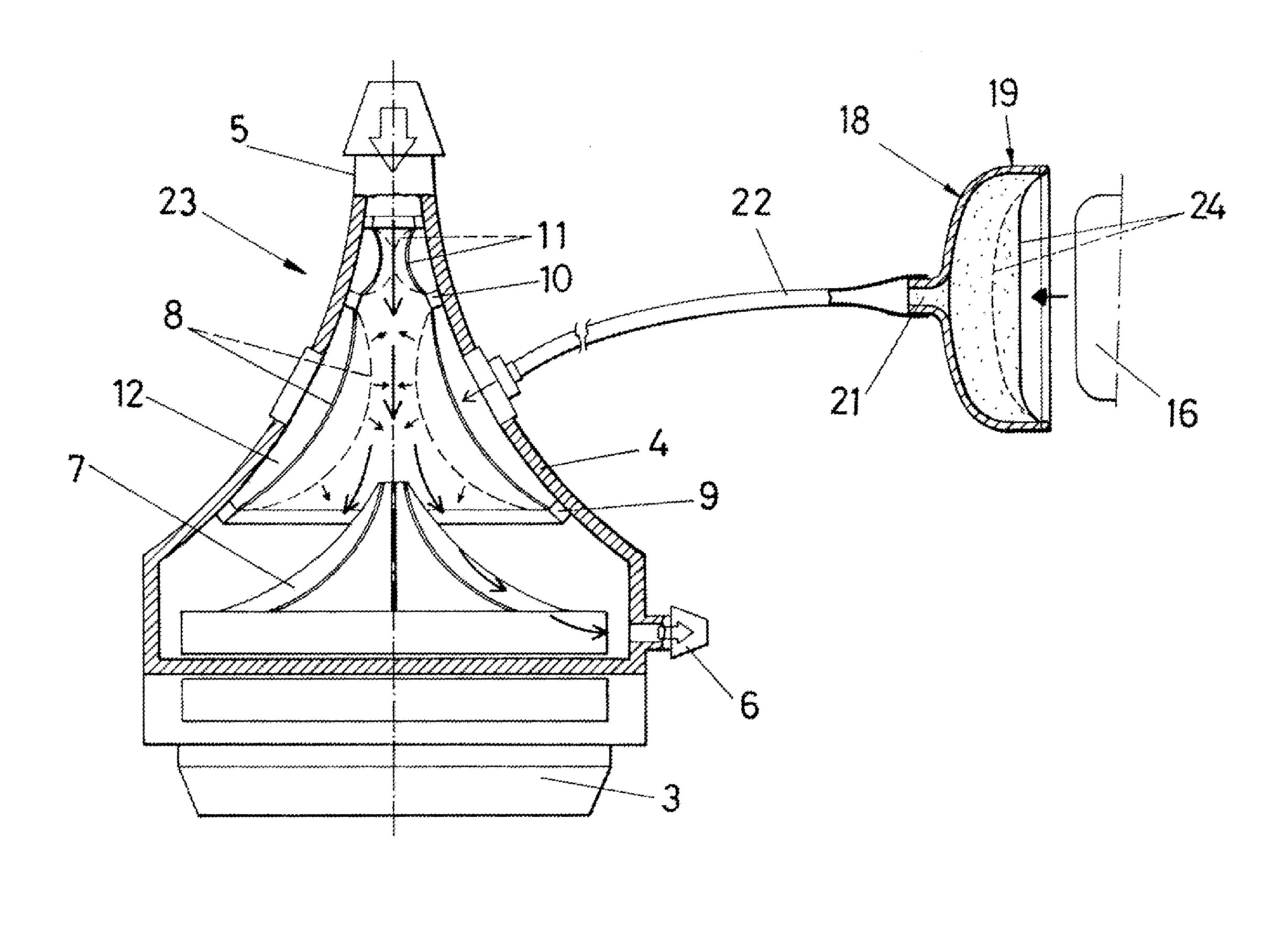 Hydraulic hydraulic pulsation equipment for a perfusion pump