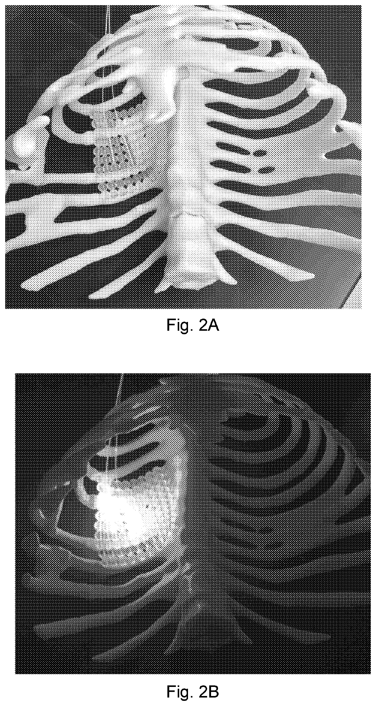 System and method for administering light therapy to curved and large surfaces