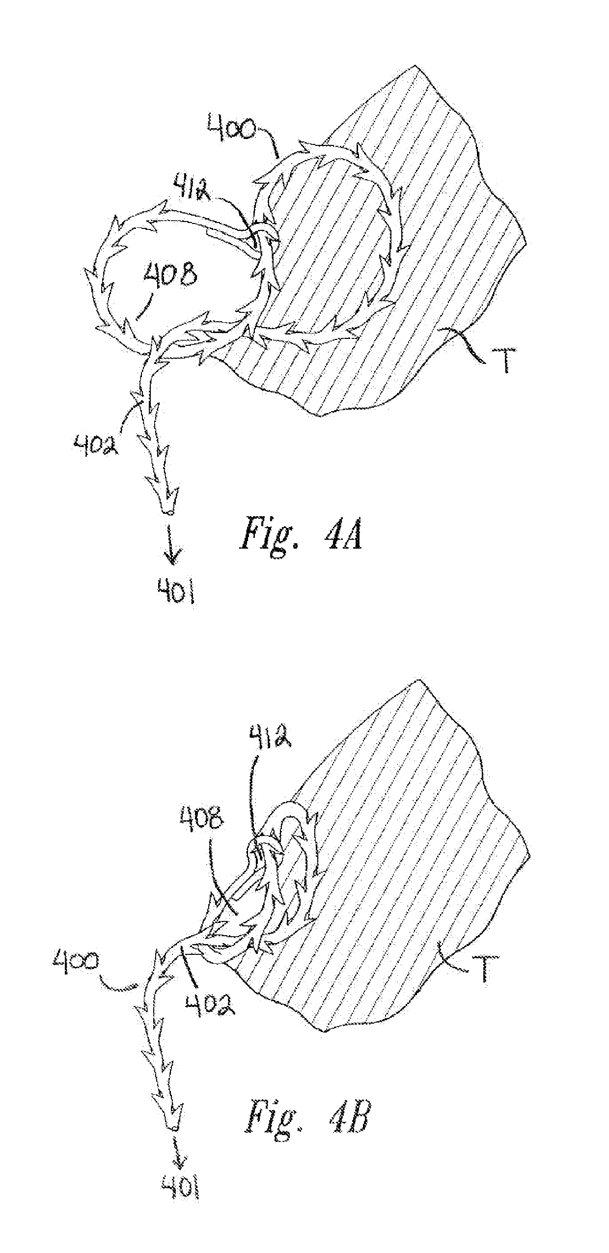 Self-retaining variable loop sutures