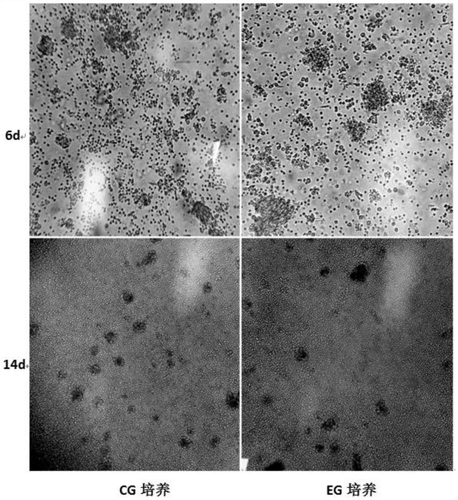 Preparation method of cytokine-induced killer cells