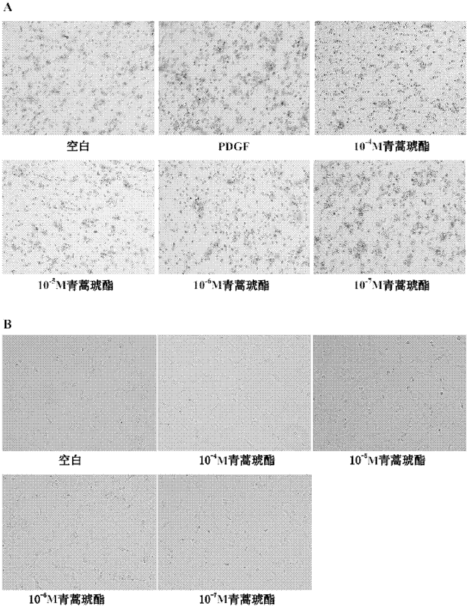 Application of artesunate in preparation of medicine used for inhibiting migration of hepatic stellate cells