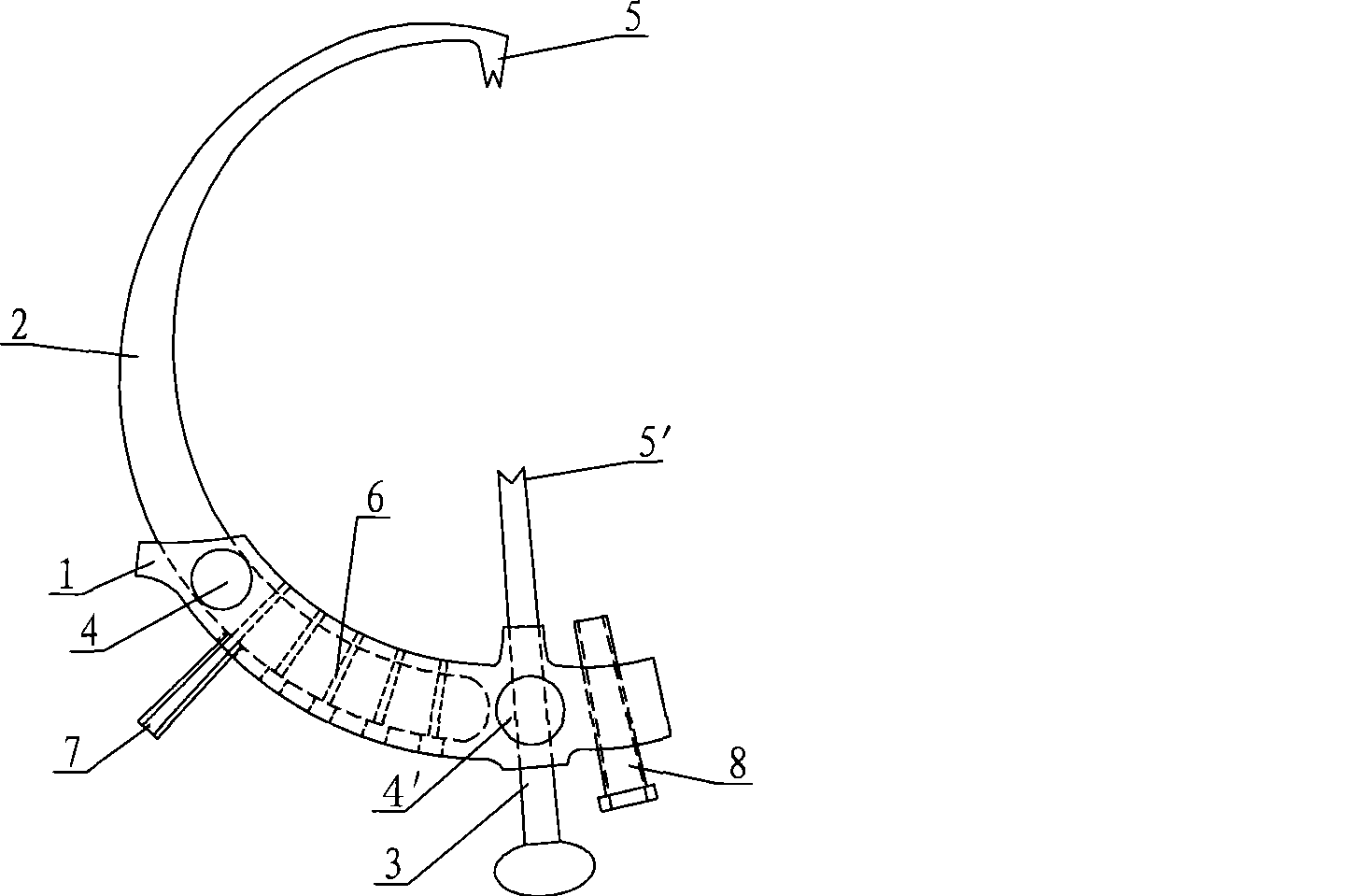 Multifunctional intra-articular fracture guide apparatus