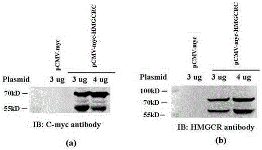 Nonradioactive detecting methods of inflammatory myopathy HMGCR (3-hydroxy3-methylutaryl coenzyme A reductase) autoantibody and application