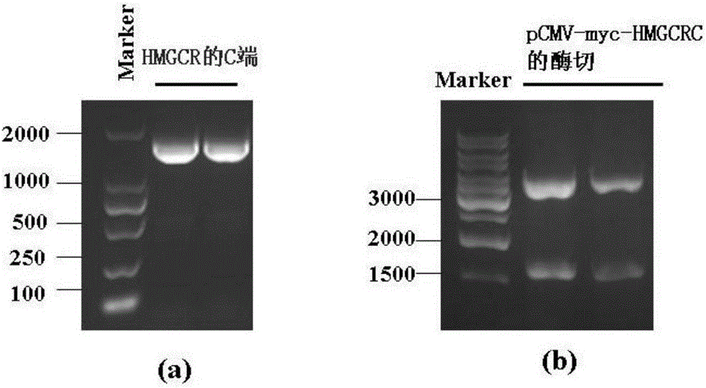 Nonradioactive detecting methods of inflammatory myopathy HMGCR (3-hydroxy3-methylutaryl coenzyme A reductase) autoantibody and application