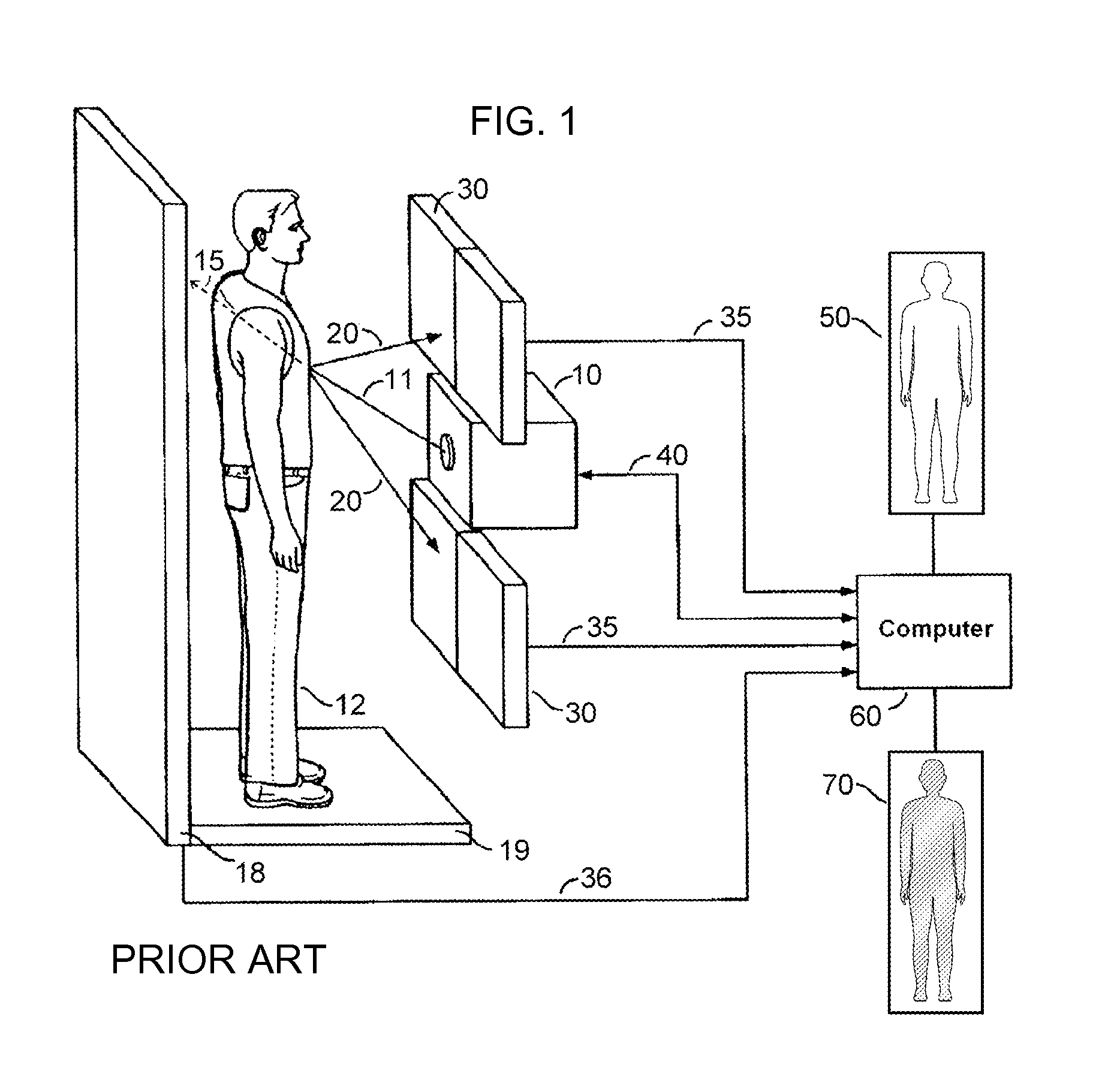 Body Scanner With Improved X-ray Transmission Imaging