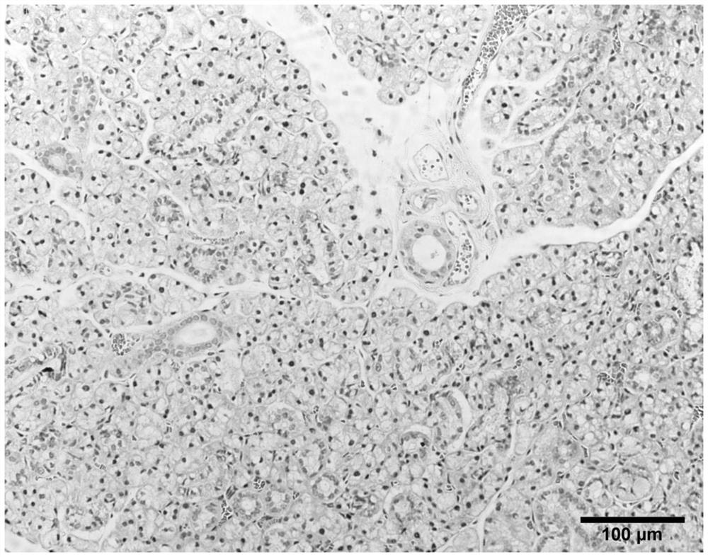 Application of MANF protein