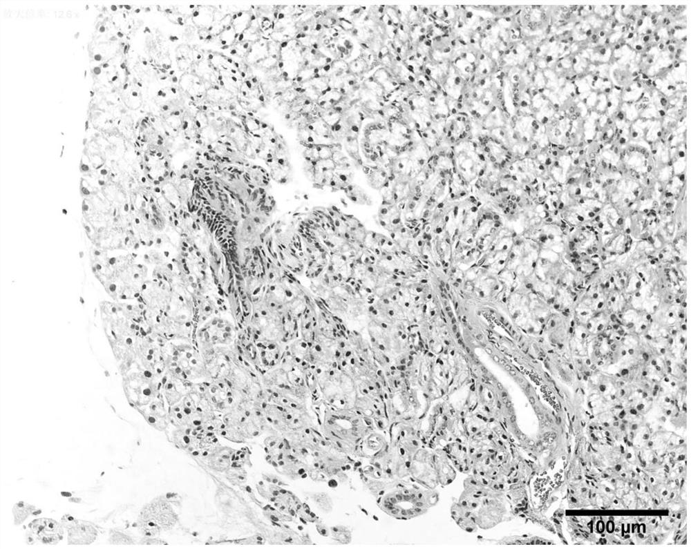 Application of MANF protein