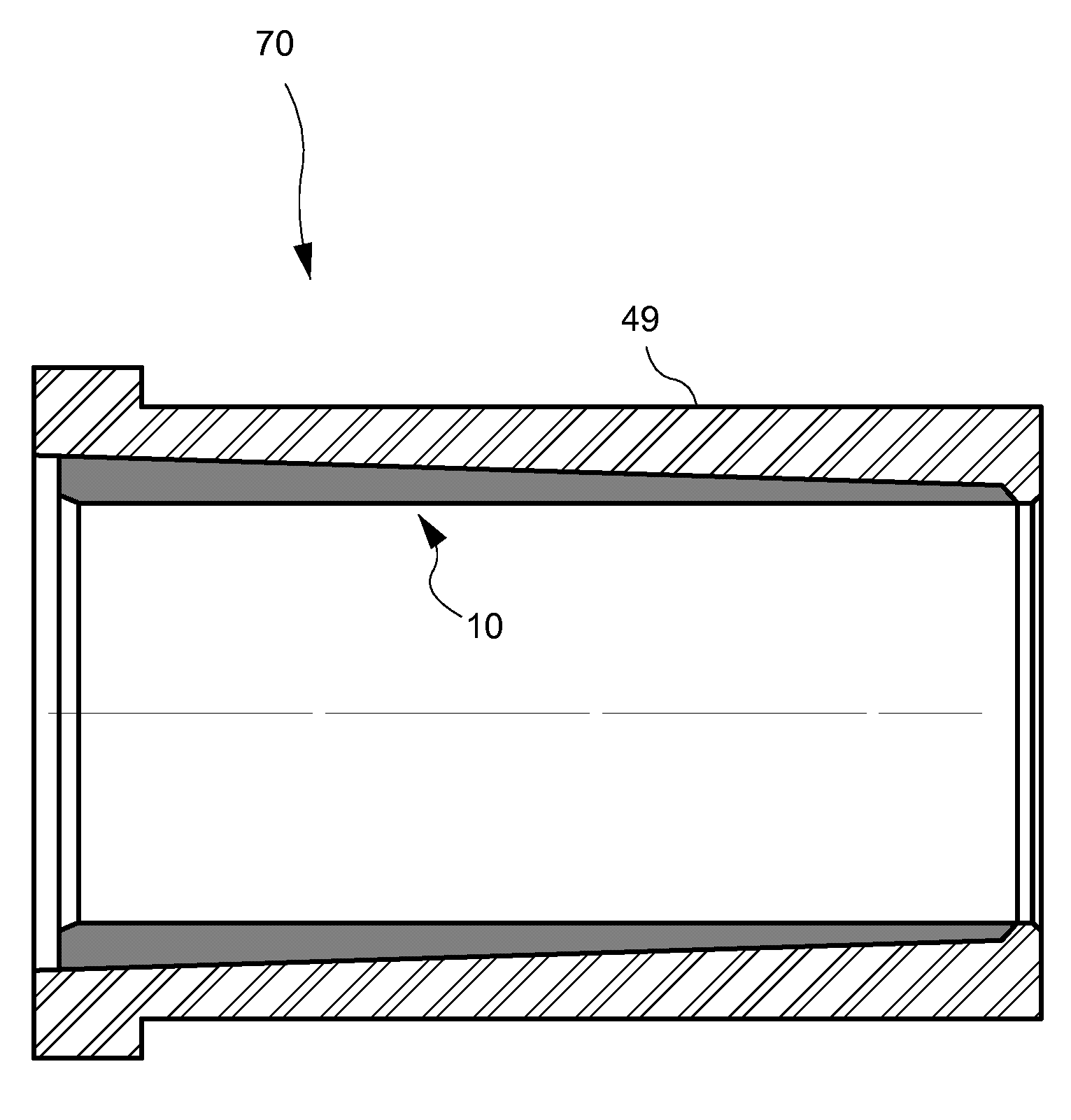 Powdered metal inlay