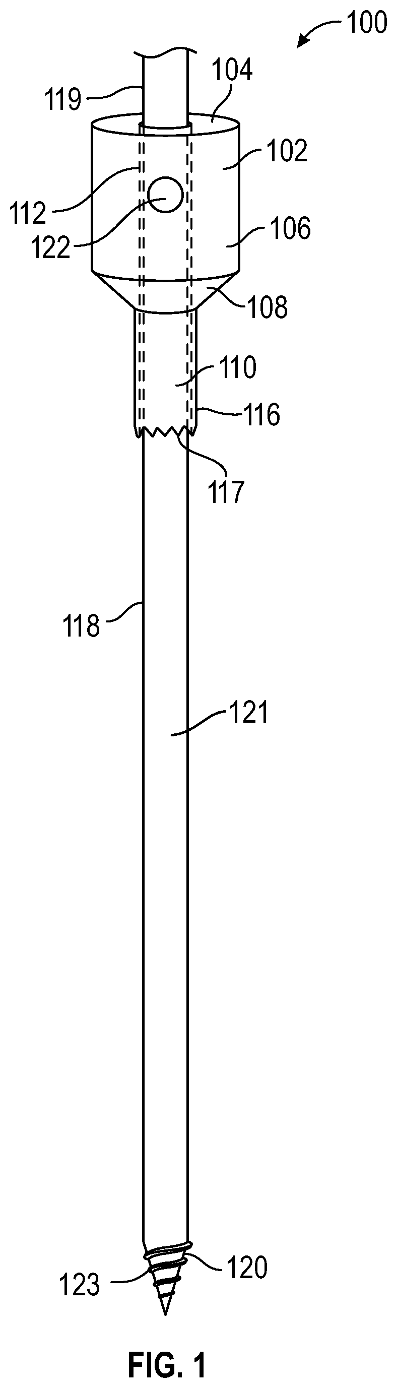 Bone fixation system