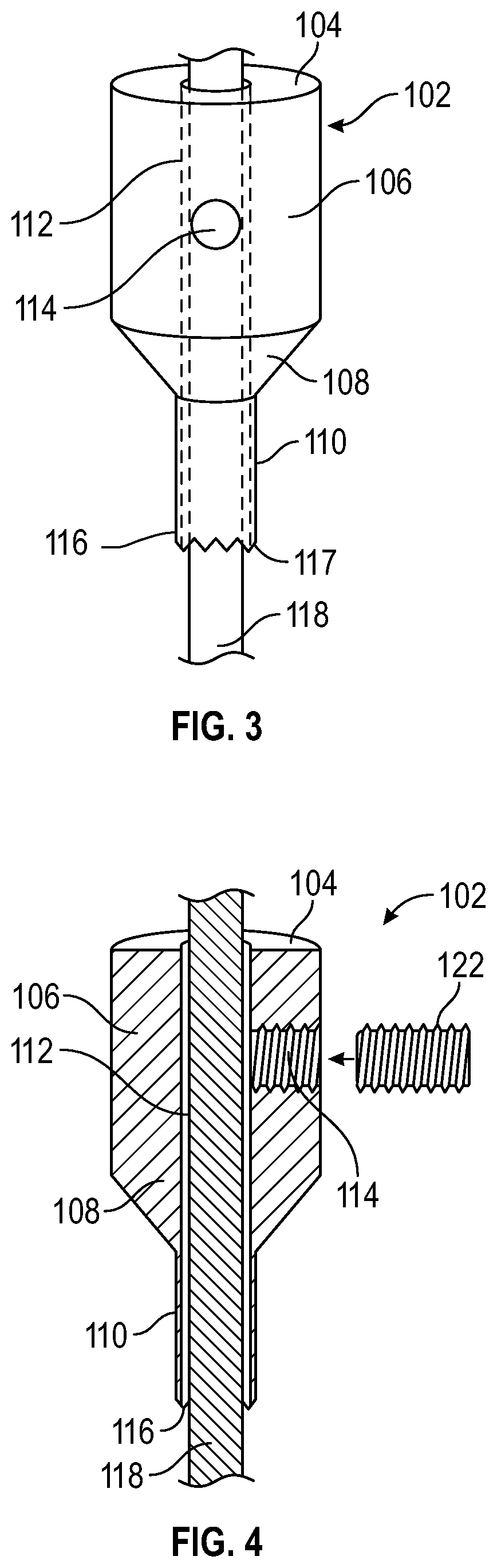 Bone fixation system