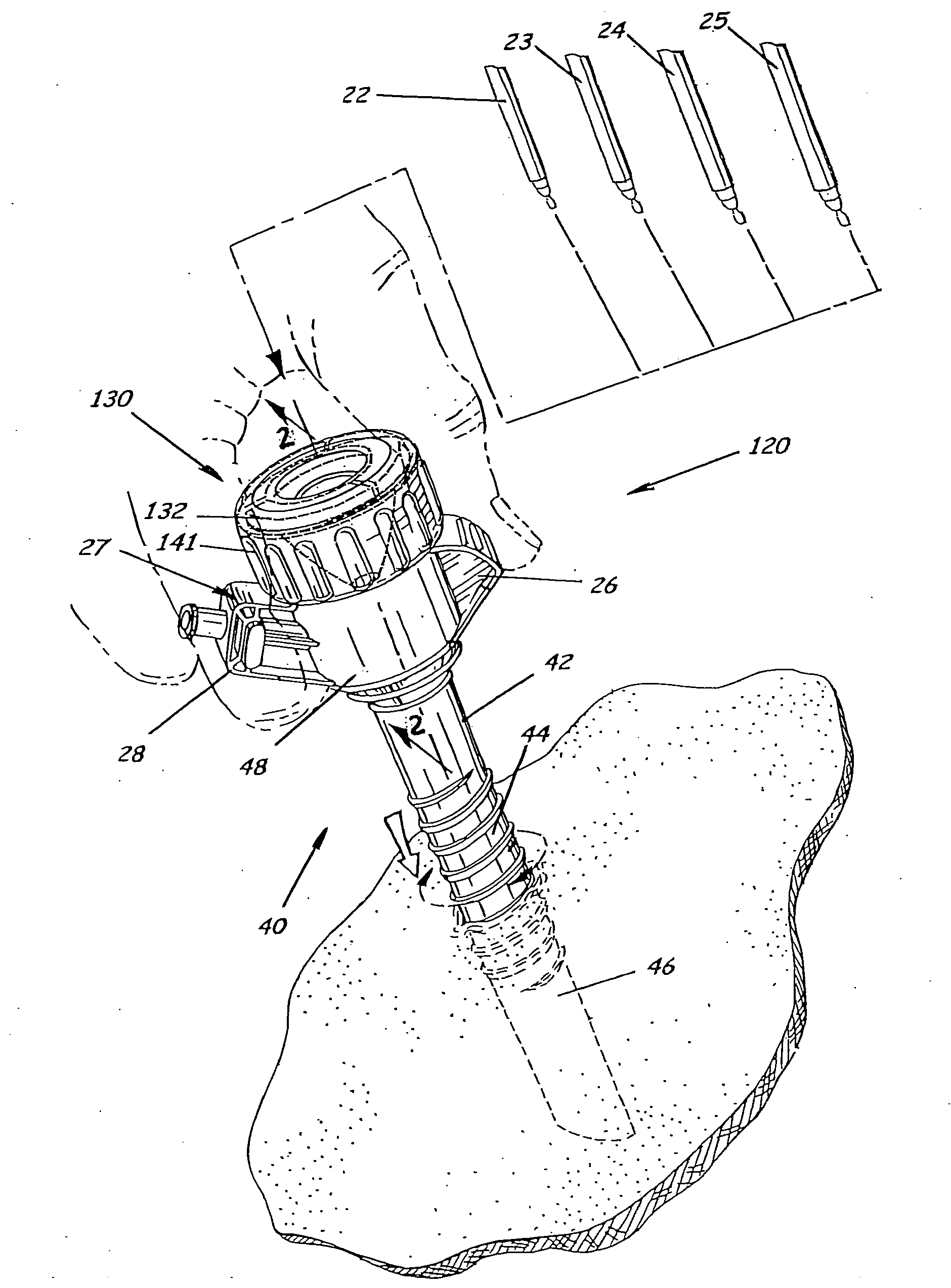 Trocar and cannula assembly having variable opening sealing gland and related methods