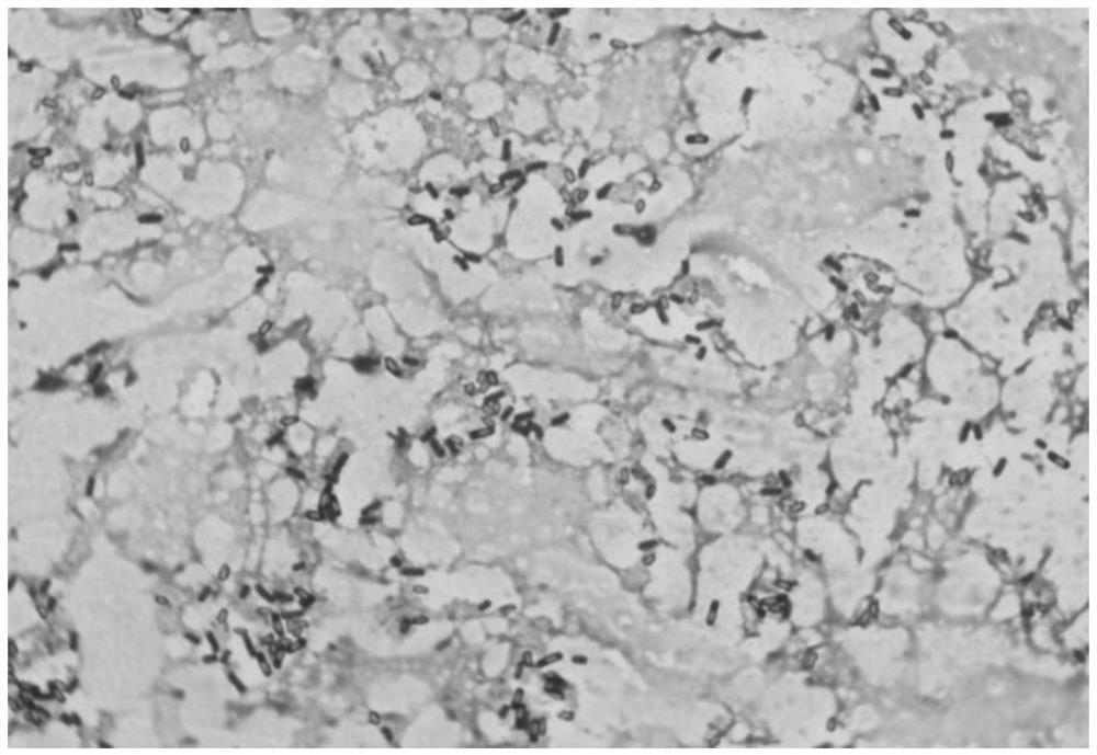 A strain of Bacillus subtilis and its culture method and application