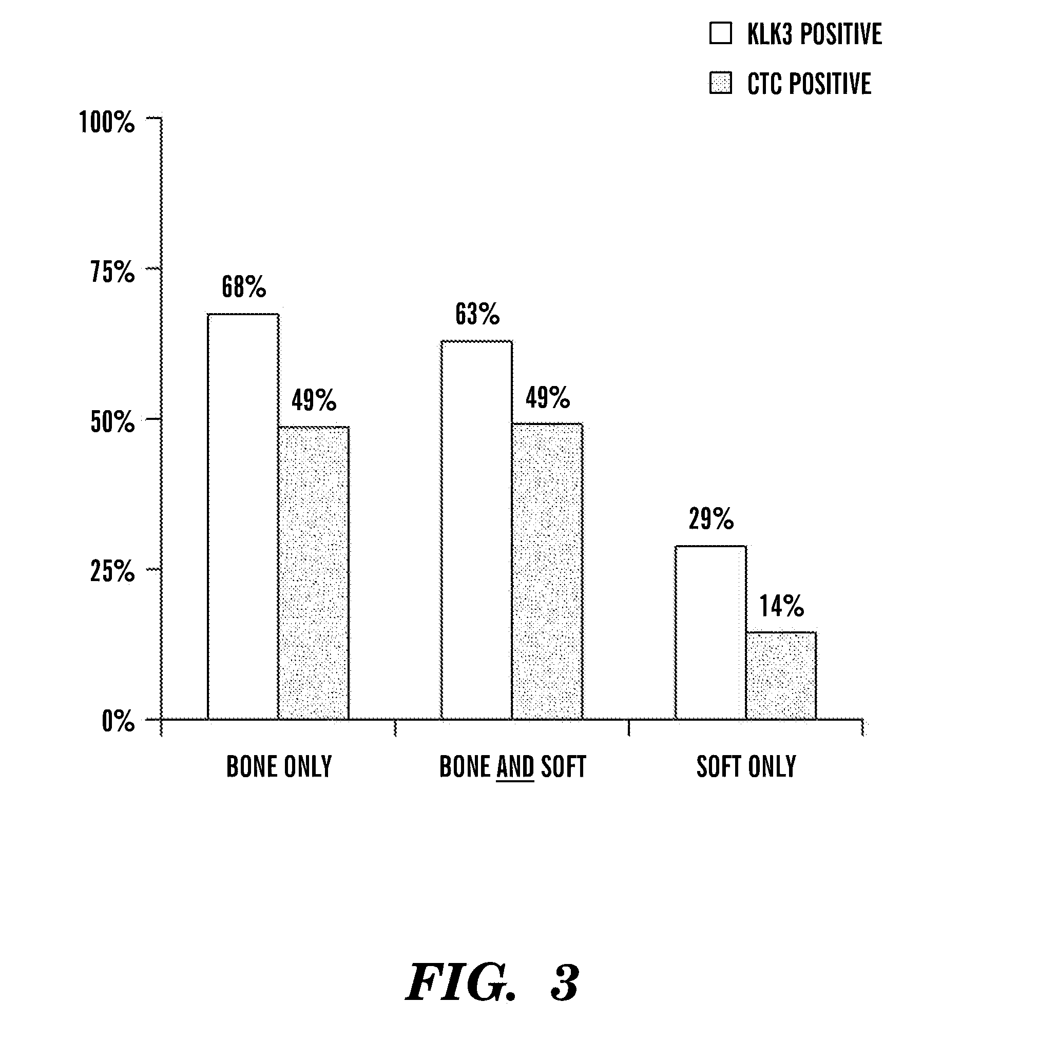 Gene expression profile associated with prostate cancer