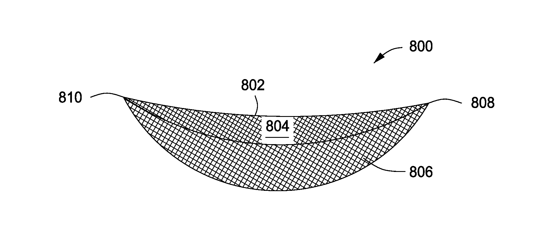 Systems and methods for mastopexy