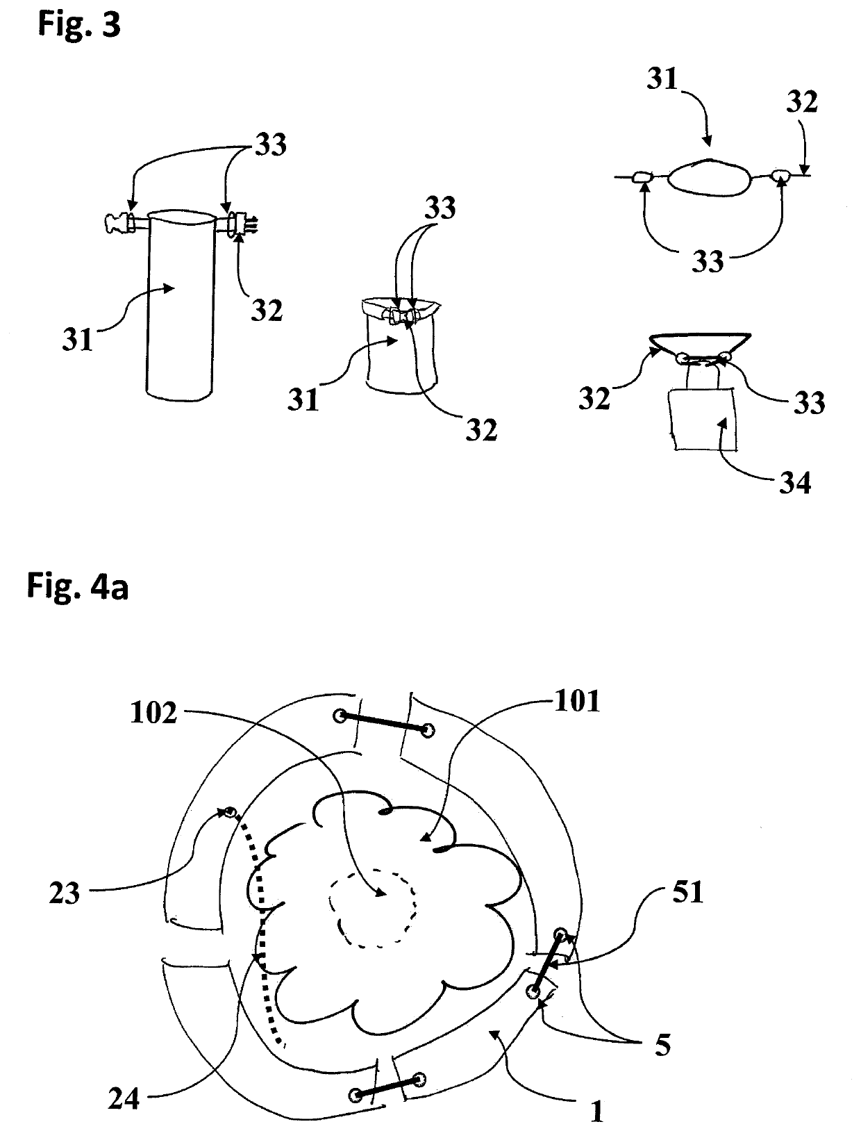 Irrigation bag and bag assembly for irrigation of primarily fully-grown, mature and veteran trees and method of tree irrigation