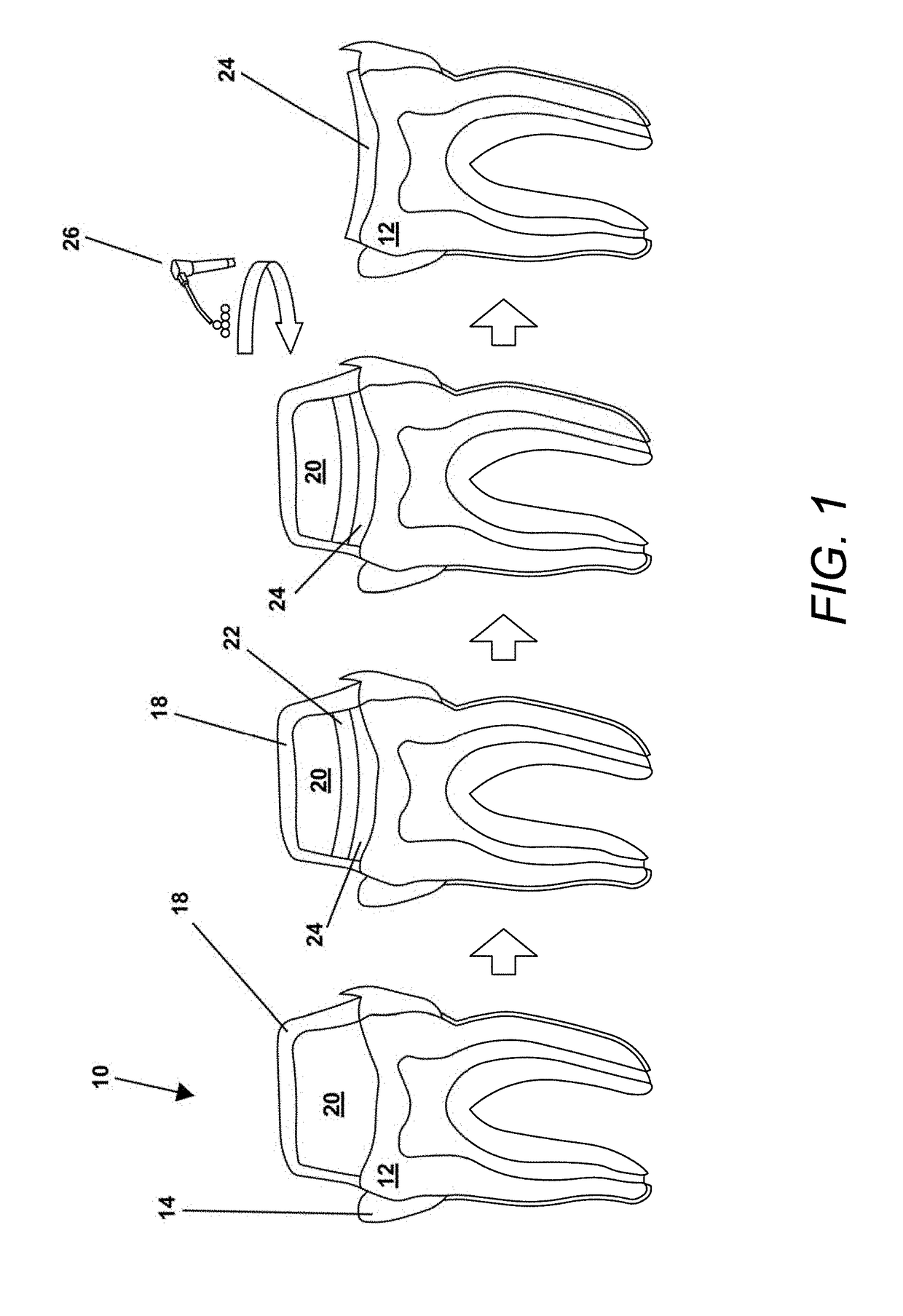 Borate bioactive glass and methods of use for dentin and enamel restoration