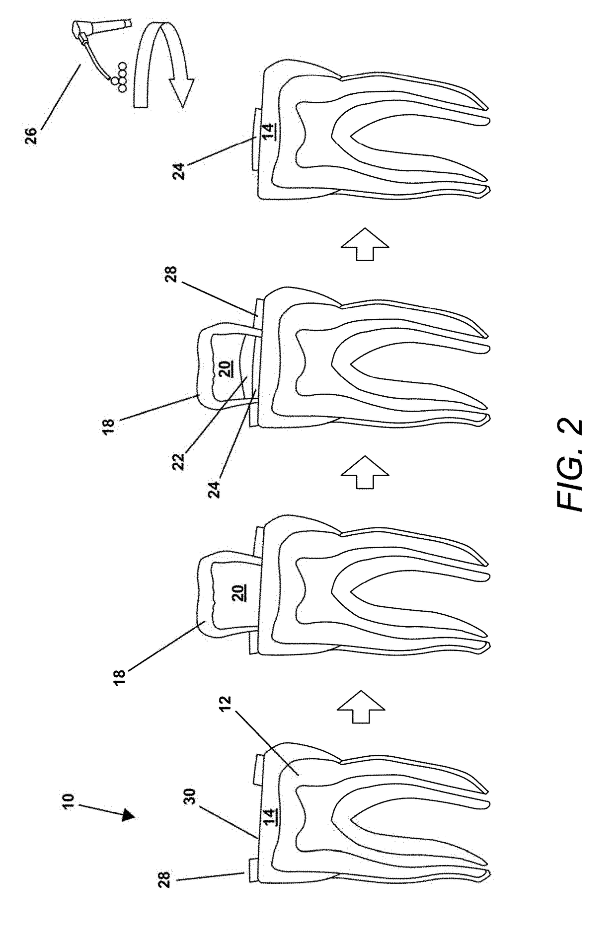 Borate bioactive glass and methods of use for dentin and enamel restoration