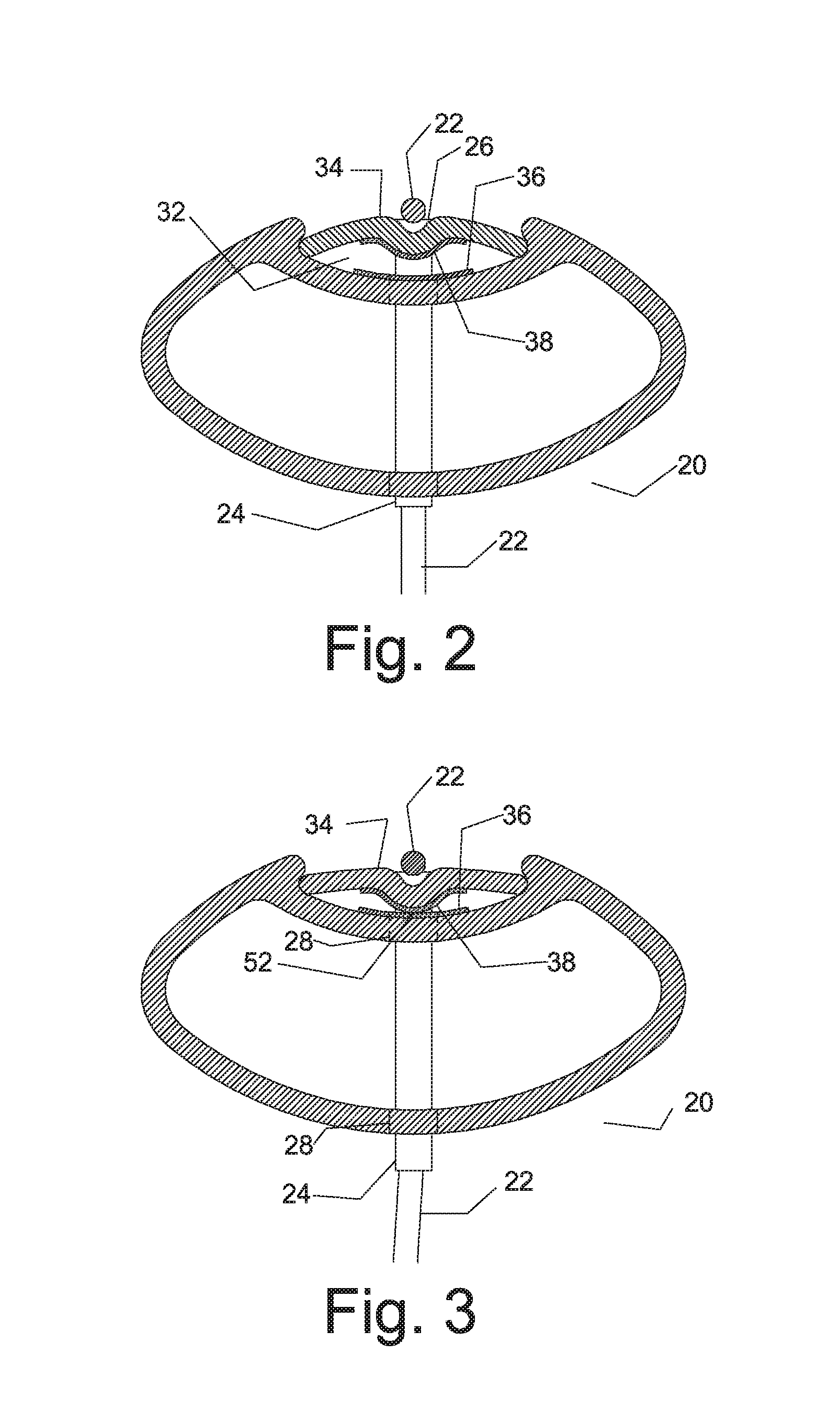 System and Method for a Game Racquet Including a Grommet Actuator