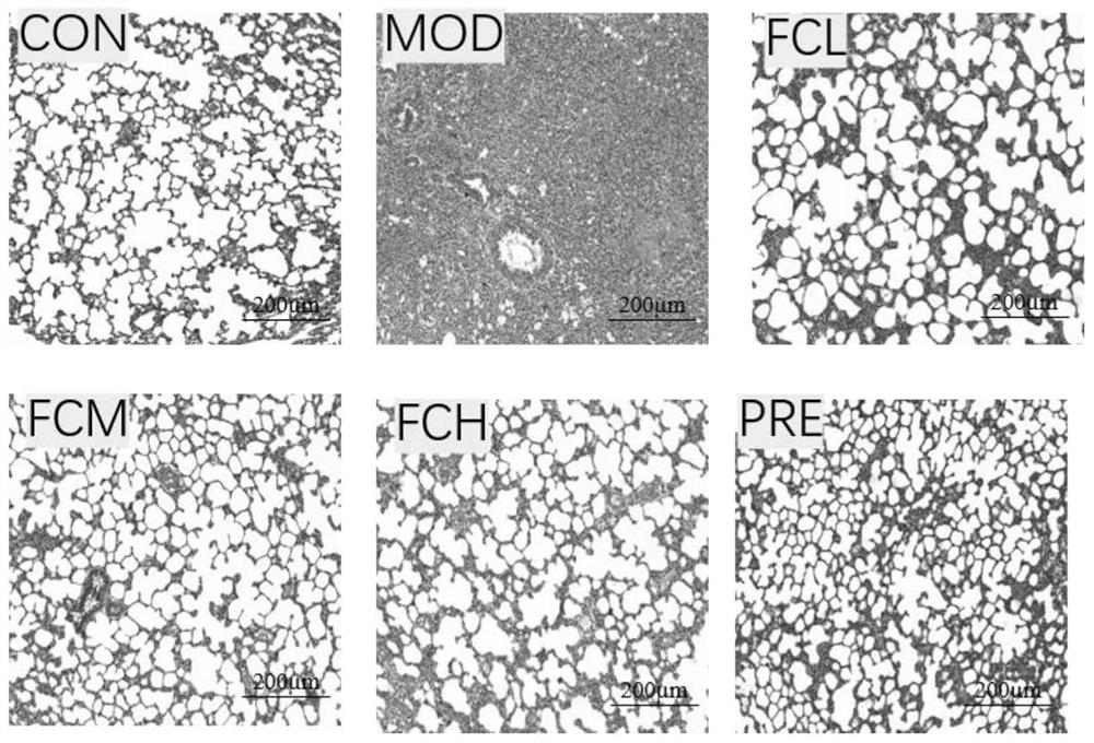 Application of leontopodium leontopodioides to preparation of medicine for treating pulmonary fibrosis