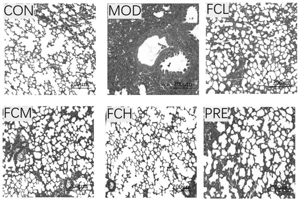 Application of leontopodium leontopodioides to preparation of medicine for treating pulmonary fibrosis