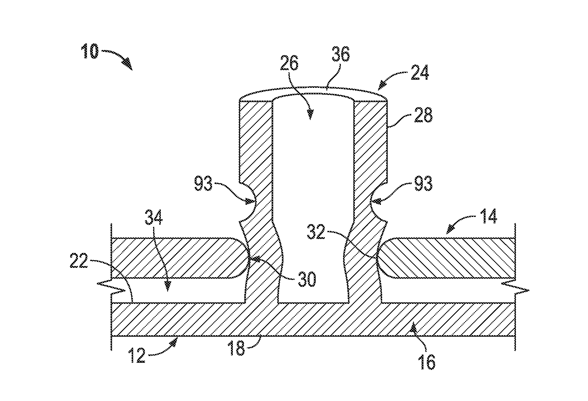 Elastically deformable energy management arrangement and method of managing energy absorption