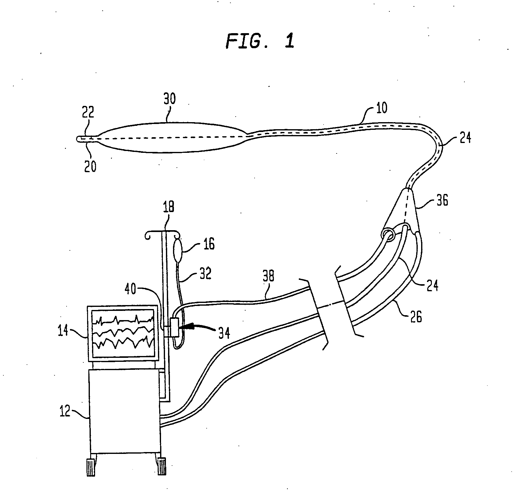 Intra-aortic balloon catheter having a dual sensor pressure sensing system