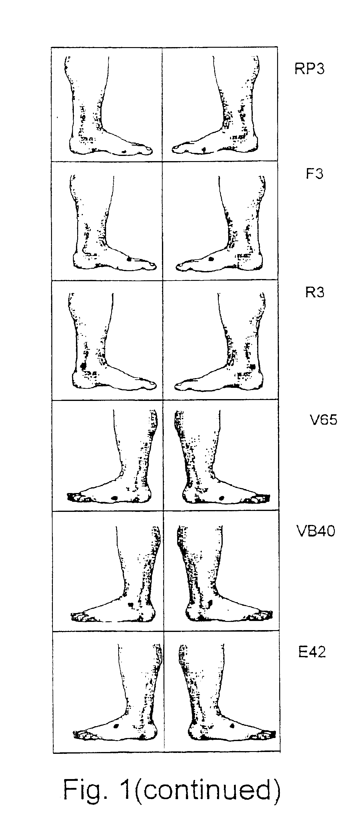 Non-invasive method for disease diagnosis