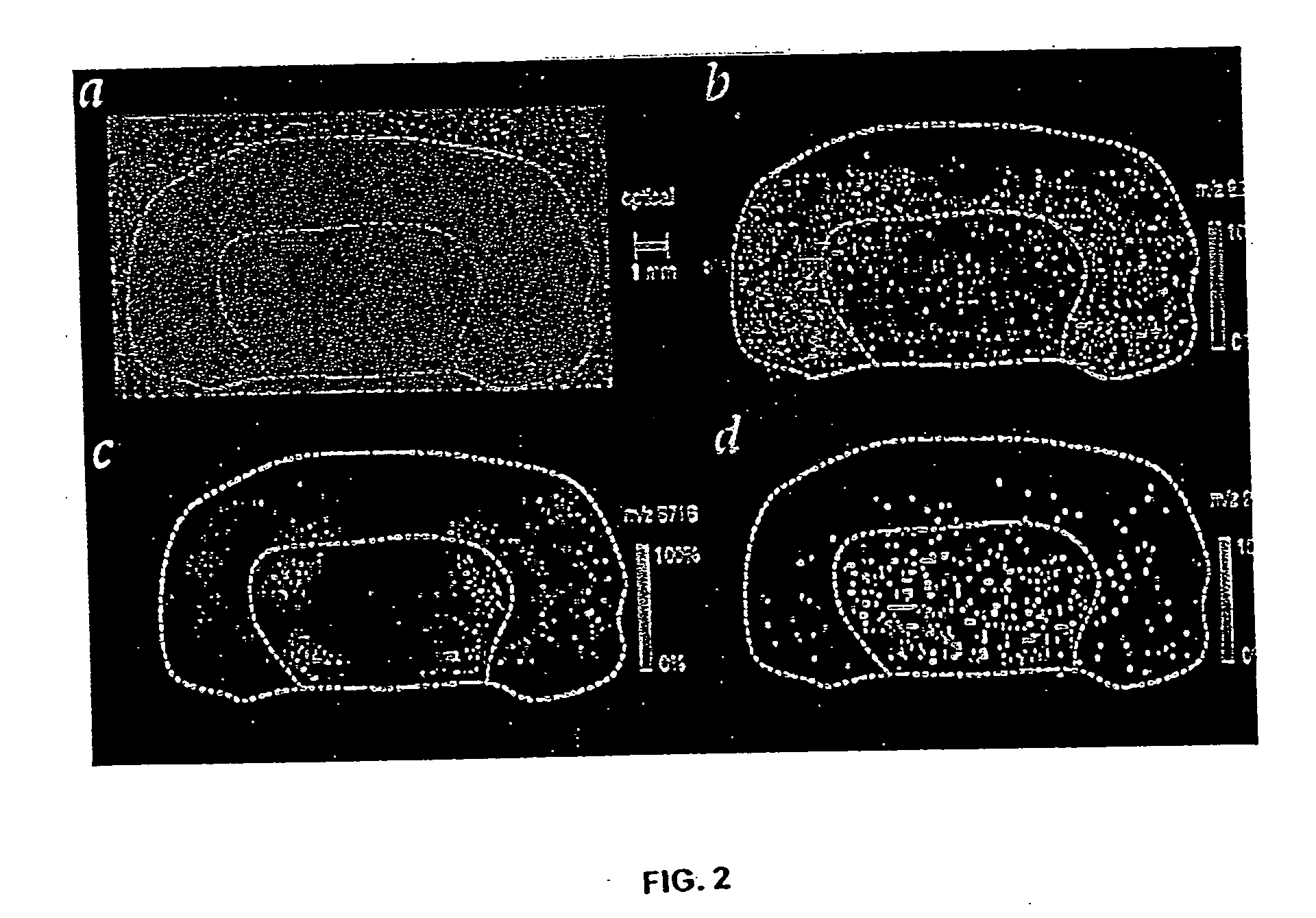 Methods and apparatuses for analyzing biological samples by mass spectrometry