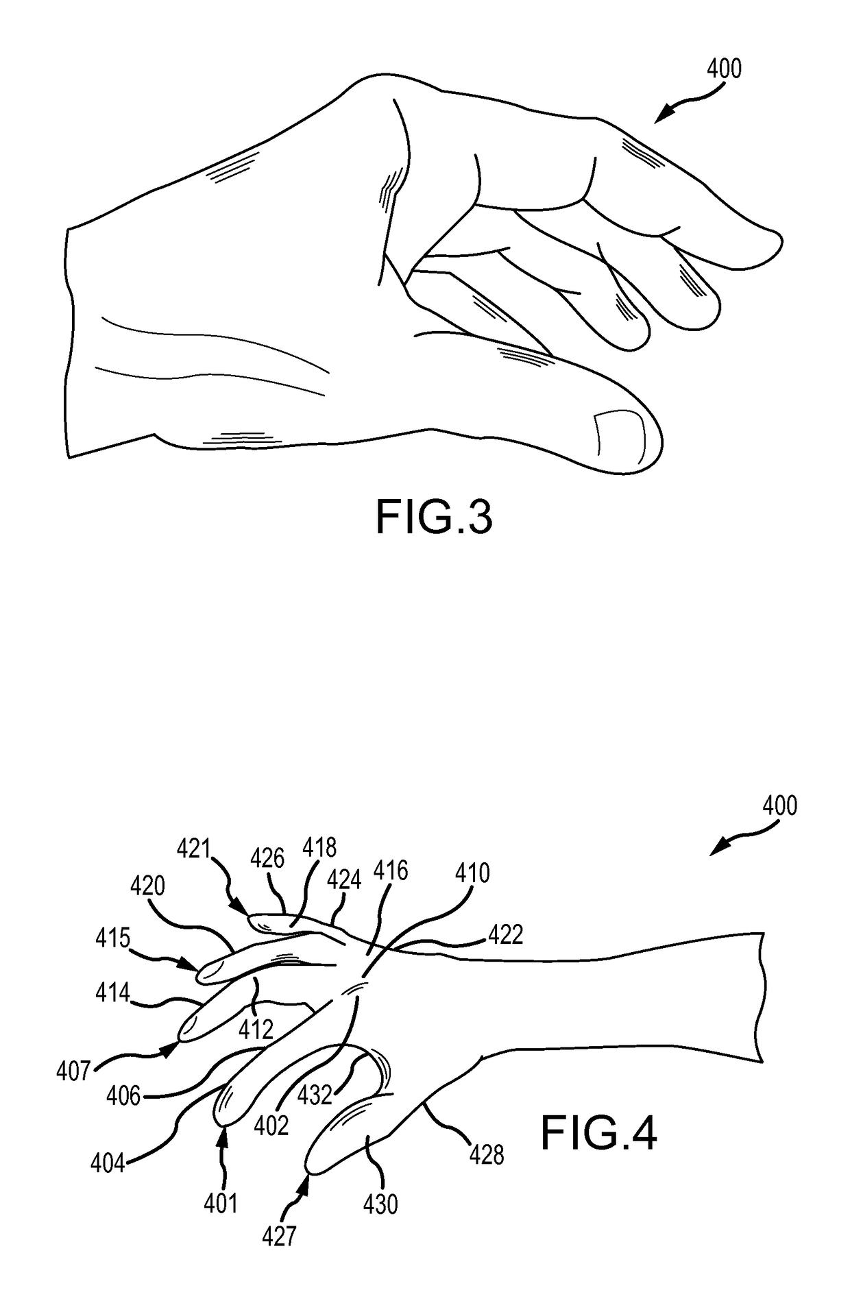 Surgical glove with ergonomic features