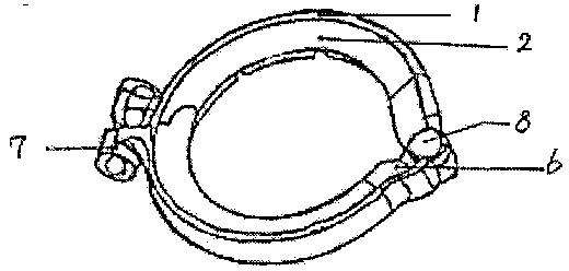 Circumcision anastomat