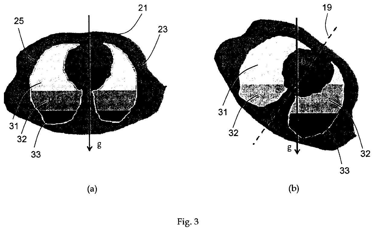 Sensor device for electrical impedance tomography imaging, electrical impedance tomography imaging instrument and electrical impedance tomography method