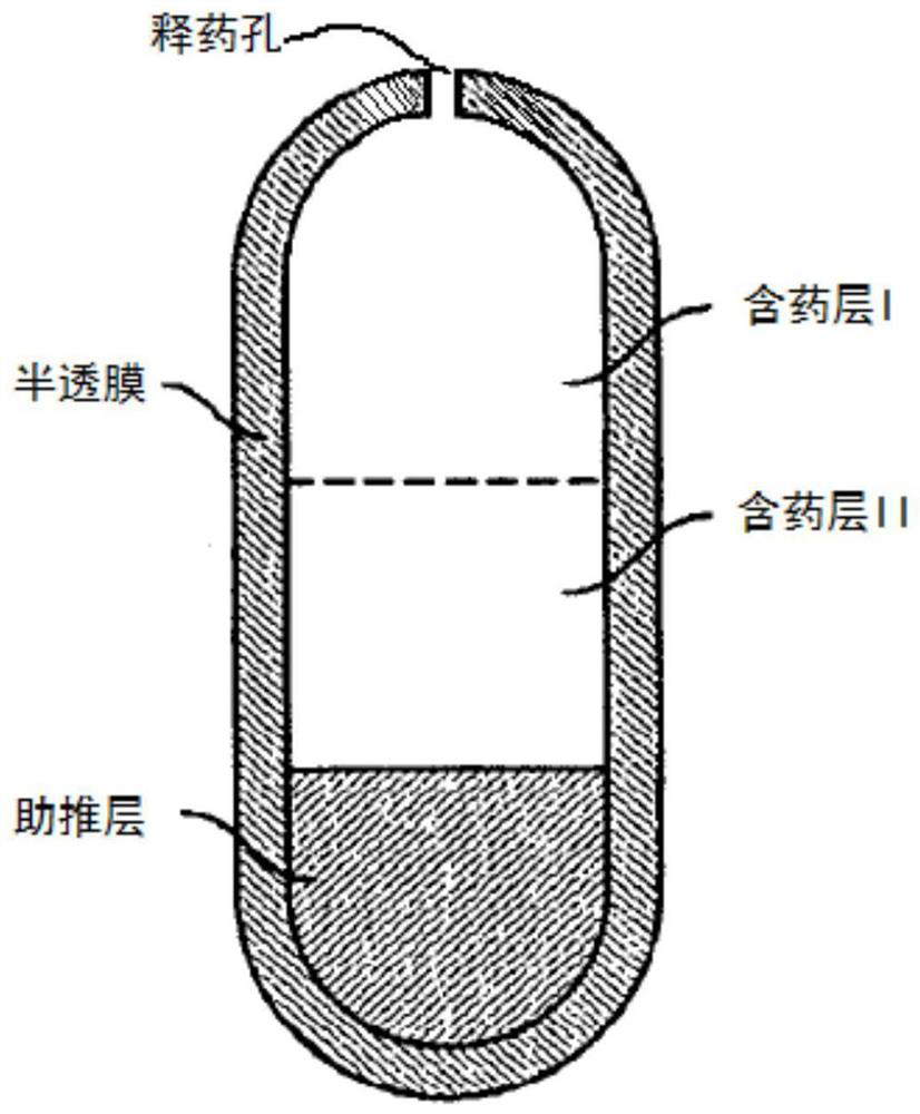 Nifedipine controlled release tablet and preparation method thereof