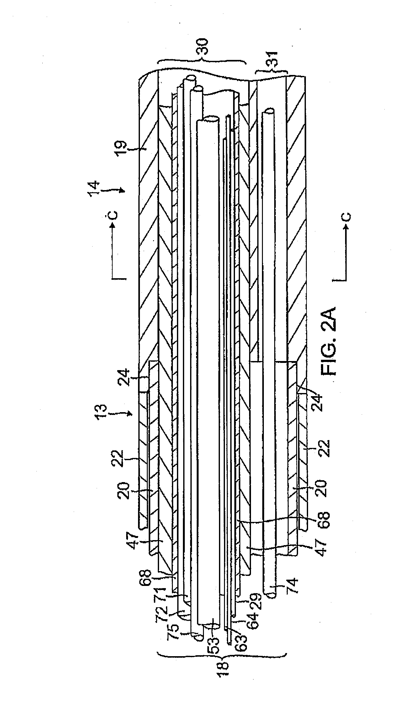 Needle catheter utilizing optical spectroscopy for tumor identification and ablation